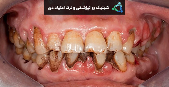 تاثیر سیگار بر دیگران