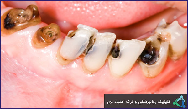 عوامل اعتیاد به مواد مخدر